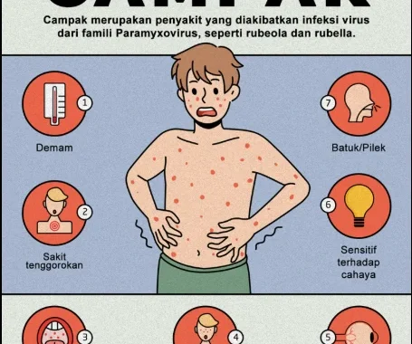 Kemenkes terbitkan SE kewaspadaan usai nakes meninggal gegara campak [titlebase] – Apa yang Perlu Anda Ketahui