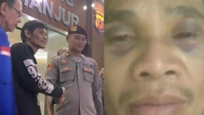Viral Jalan Berlumpur Makan Korban di Cianjur, Dedi Mulyadi Langsung Minta Pemkab Bertindak – tvOneNews