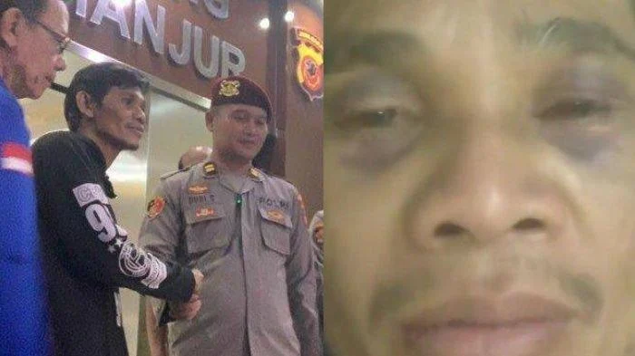 Viral Jalan Berlumpur Makan Korban di Cianjur, Dedi Mulyadi Langsung Minta Pemkab Bertindak – tvOneNews